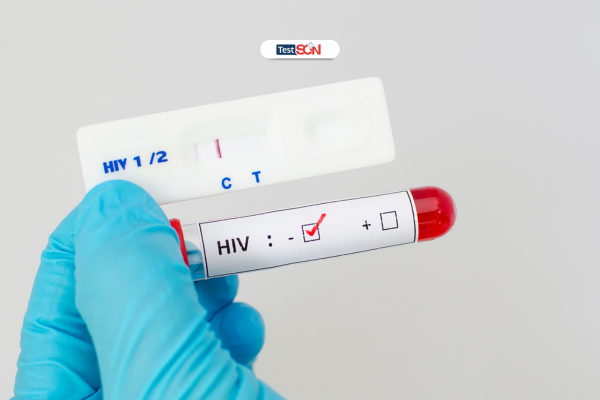 Âm tính với HIV là điều cần lưu ý trước khi dùng PrEP