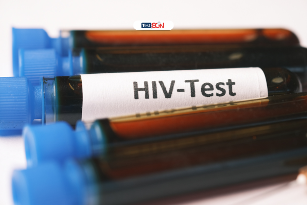 Cần làm xét nghiệm trong thời kỳ cửa sổ HIV hay không?