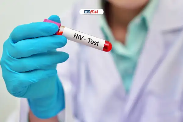 HÌNH ẢNH QUE TEST HIV CHO KẾT QUẢ NHANH TRONG 20 PHÚT