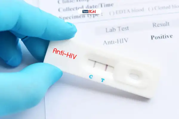 Phòng khám TESTSGN là địa chỉ xét nghiệm HIV uy tín, giá cả phù hợp