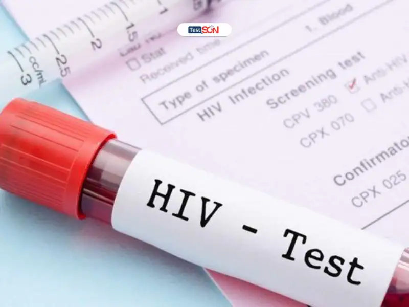 Giai đoạn cửa sổ HIV kéo dài bao lâu