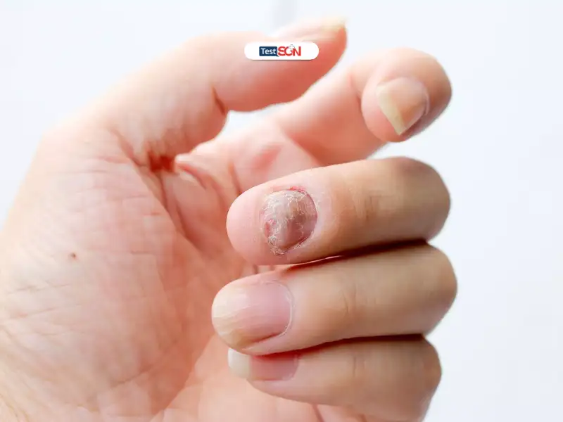 Chỉ khi dụng cụ dính máu và gây chảy máu cho người sau, nguy cơ lây nhiễm mới tồn tại.