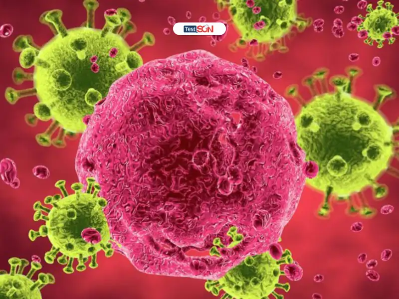 Triệu chứng HIV giai đoạn cuối là gì?