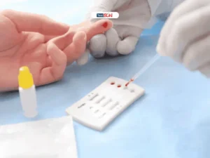 Xét Nghiệm Giang Mai Bao Nhiêu Tiền? Bảng Giá Và Địa Chỉ Uy Tín