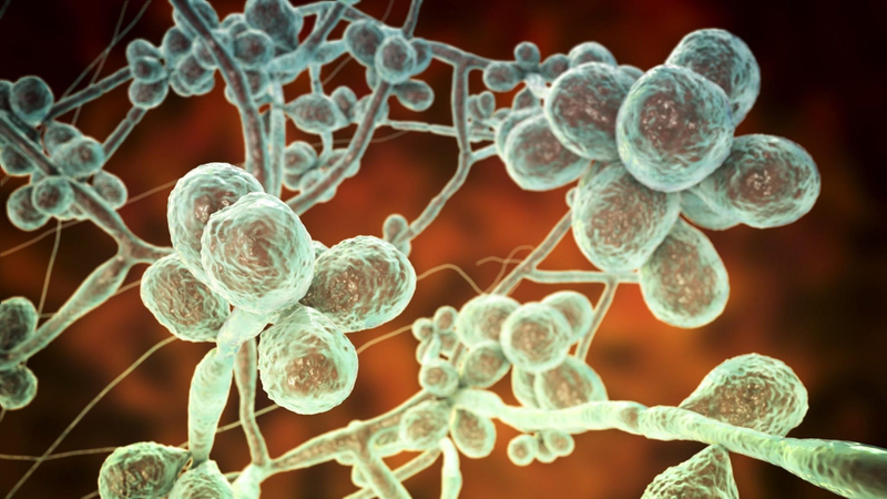 Nhiễm nấm Sporotrichosis là bệnh nhiễm trùng do nấm Sporothrix schenckii gây ra