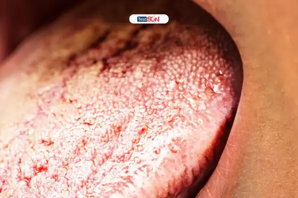 Xét nghiệm HIV sớm giúp phát hiện bệnh và điều trị kịp thời.
