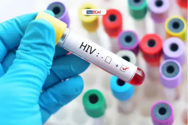  Xét nghiệm HIV định kỳ theo đúng lịch trình là cách tốt nhất để xác định chính xác tình trạng sức khỏe.