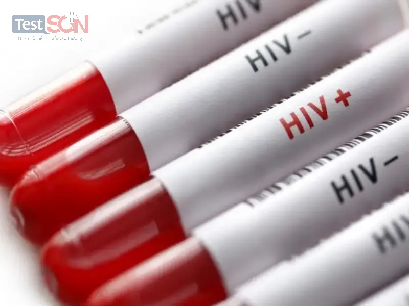 Xét nghiệm HIV 6 tháng an toàn chưa