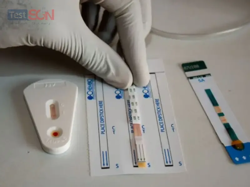Xét nghiệm HIV 6 tháng an toàn chưa