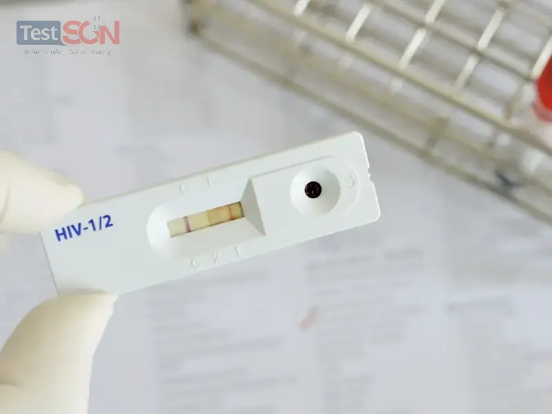 Xét nghiệm HIV 6 tháng an toàn chưa