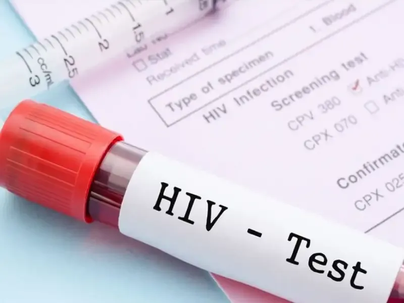 Trước khi xét nghiệm HIV có cần nhịn ăn không??
