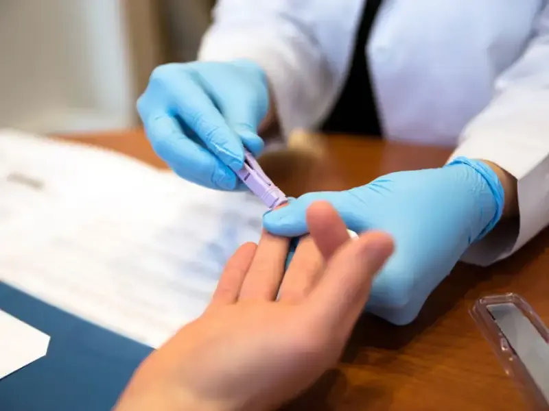 Trước khi xét nghiệm HIV có cần nhịn ăn không??