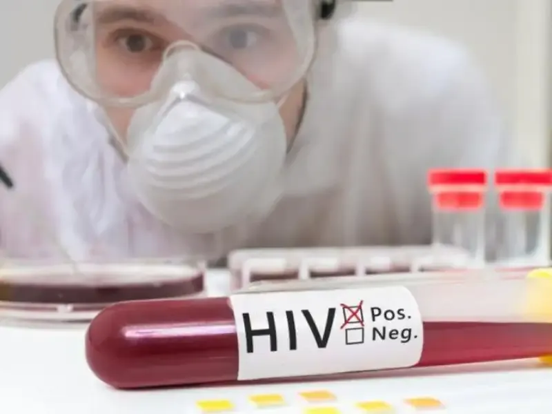Trước khi xét nghiệm HIV có cần nhịn ăn không??
