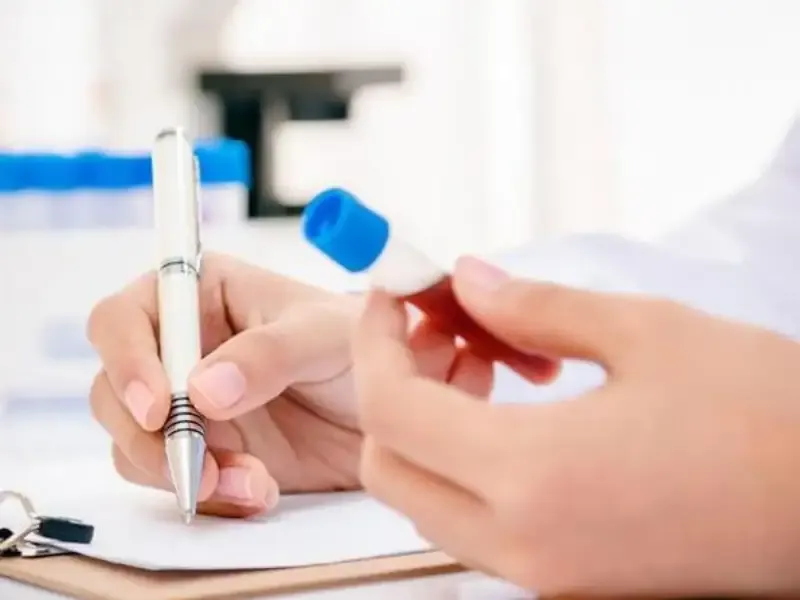 Trước khi xét nghiệm HIV có cần nhịn ăn không??