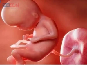 Giang mai bẩm sinh: Dấu hiệu, triệu chứng, và cách điều trị