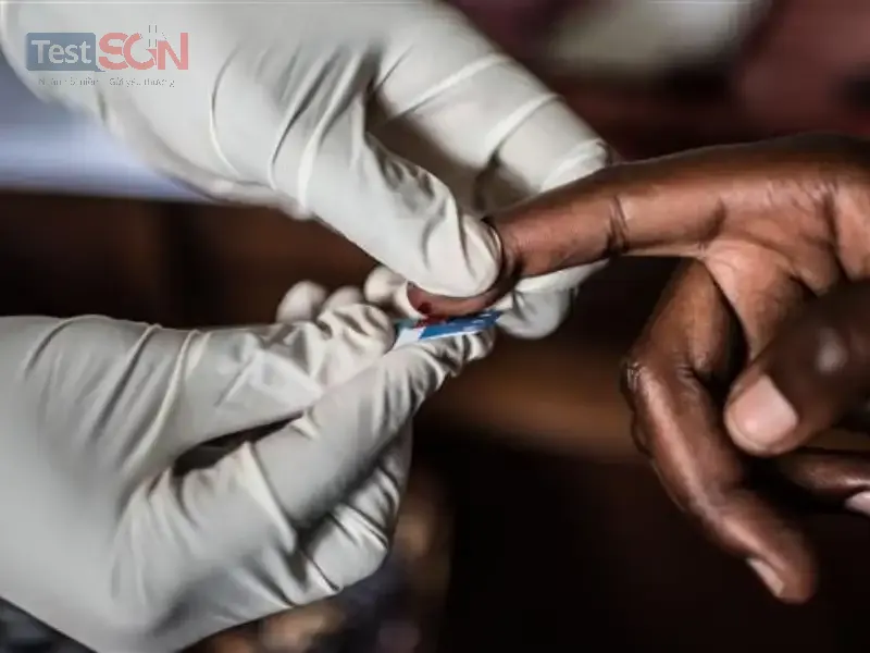 Xét nghiệm Anti HIV là gì? có đáng tin cậy không?