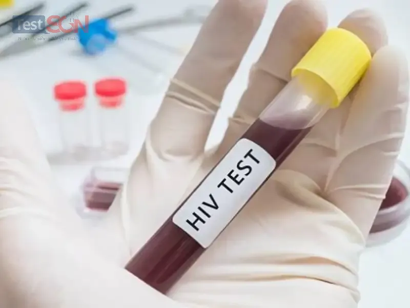 Xét nghiệm Anti HIV là gì? có đáng tin cậy không?