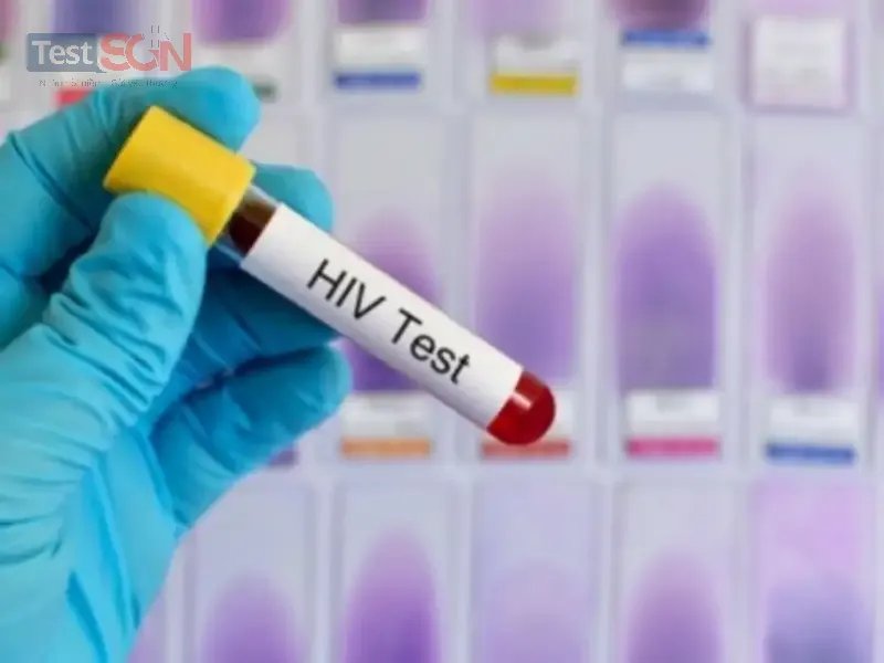 Xét nghiệm Anti HIV là gì? có đáng tin cậy không?
