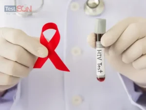 Tìm hiểu chi tiết về xét nghiệm PCR HIV