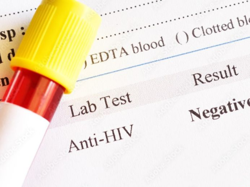Thời gian và hình thức thông báo kết quả xét nghiệm dương tính HIV