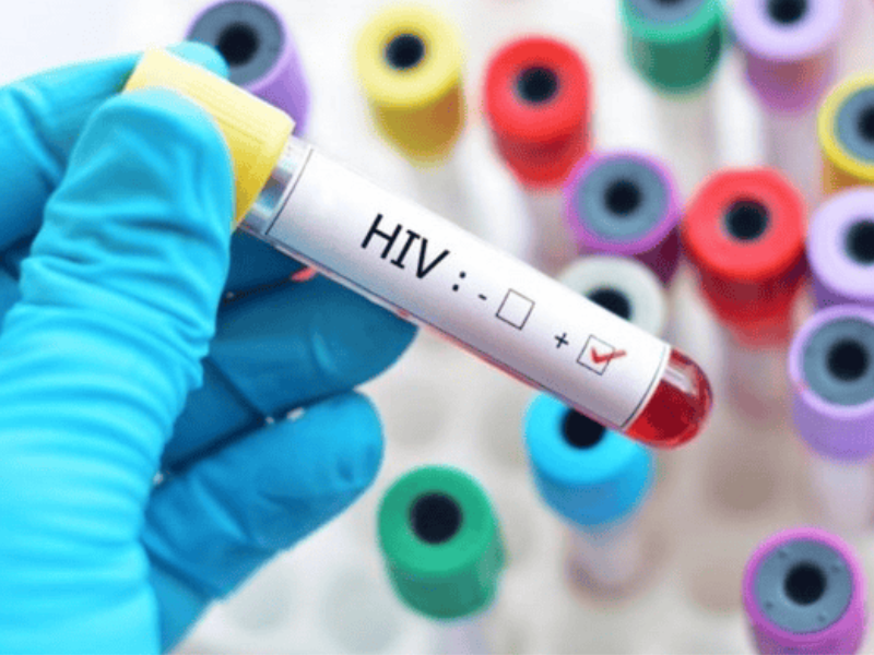 Lựa chọn xét nghiệm HIV ở đâu đảm bảo an toàn và bảo mật thông tin tốt nhất?
