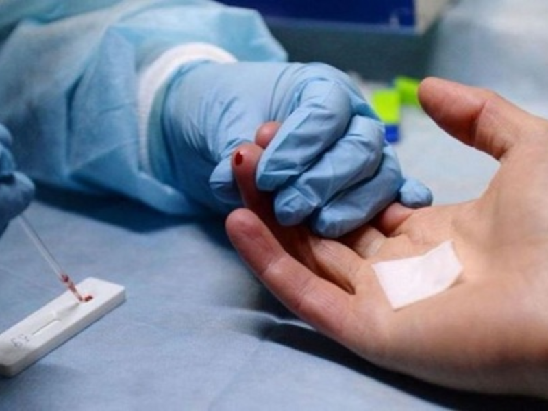 Mẫu giấy xét nghiệm HIV dương tính mới nhất