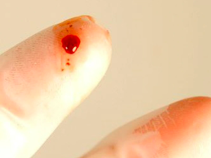 Lượng máu đủ để lây nhiễm HIV là bao nhiêu