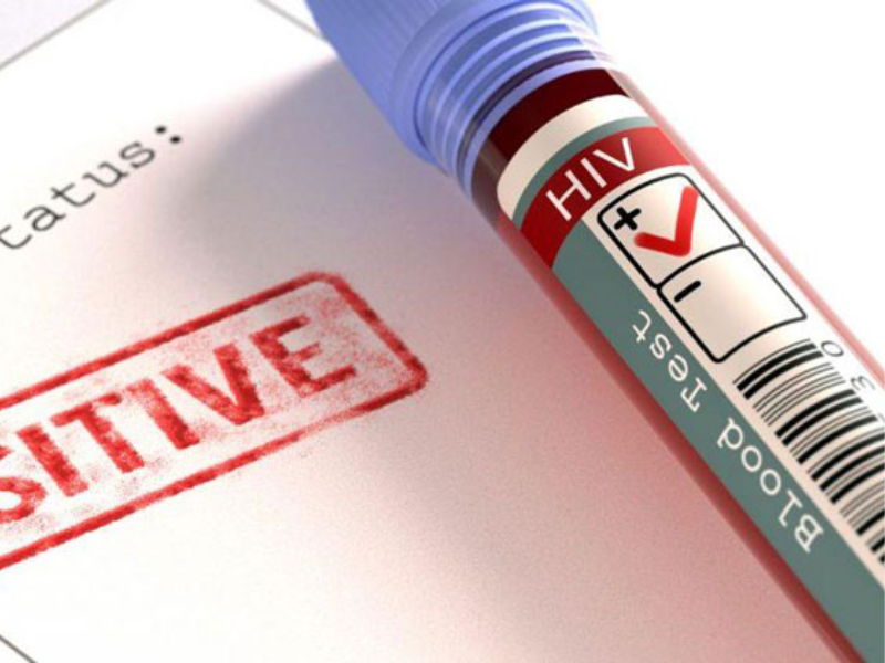 Thời điểm xét nghiệm HIV dựa trên phương pháp thực hiện