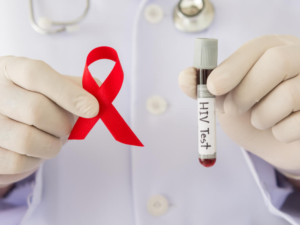 Xét nghiệm HIV sau khi dùng PEP