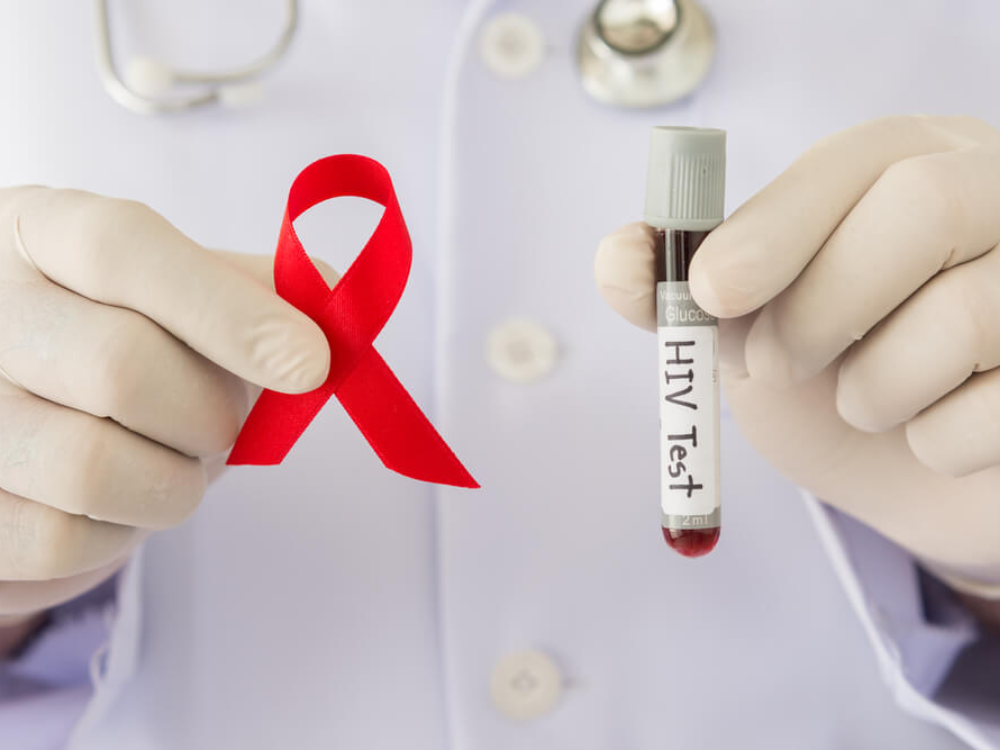 Xét nghiệm HIV sau khi dùng PEP