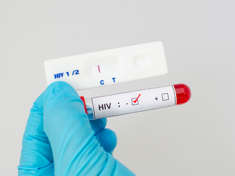 Dùng PEP có ảnh hưởng đến kết quả xét nghiệm HIV không?