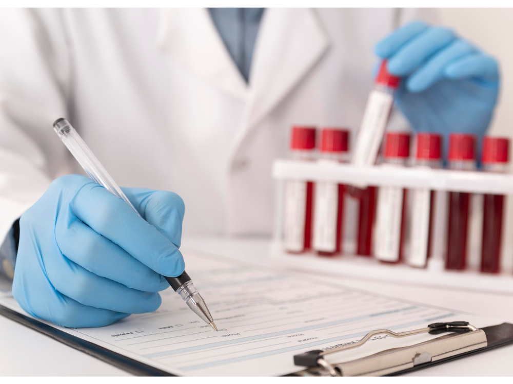 Có nên xét nghiệm HIV Combi PT 28 ngày sau khi dùng PEP không?