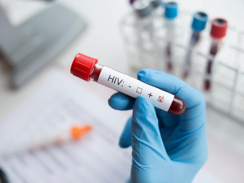HIV không lây qua nước
