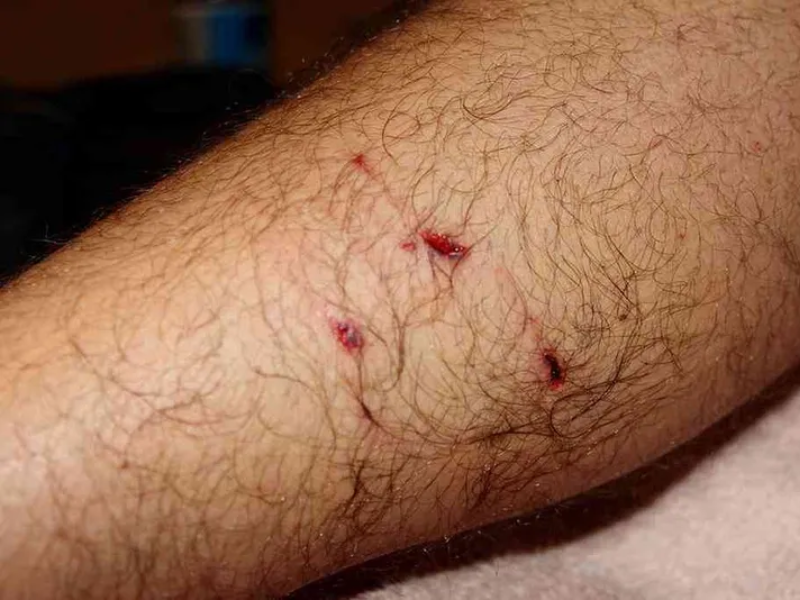 Môi trường và điều kiện sống lý tưởng của virus HIV