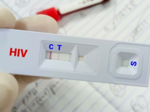 Xét nghiệm HIV bao lâu có kết quả?
