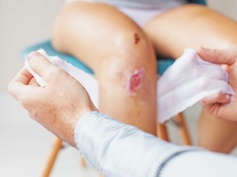 Vết thương lâu lành có phải bị HIV