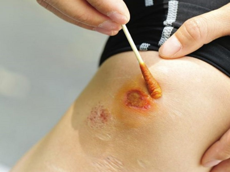 Xét nghiệm PCR 