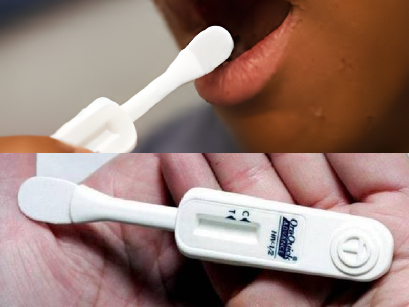 XÉT NGHIỆM HIV BẰNG NƯỚC BỌT
