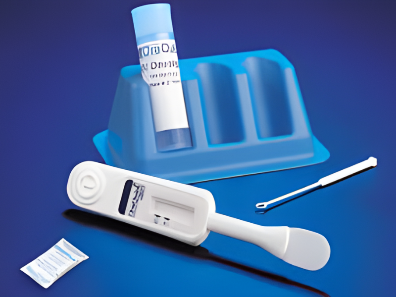 Ưu và nhược điểm xét nghiệm HIV bằng nước bọt
