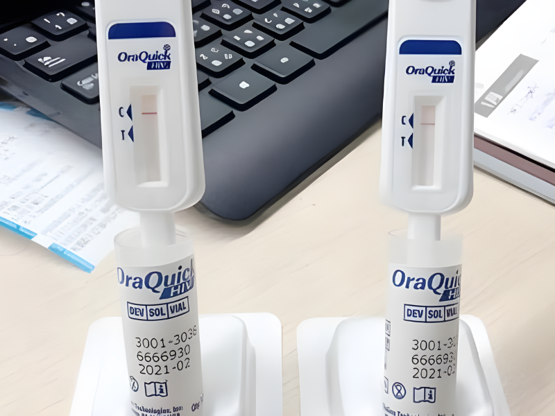 Quy trình thực hiện xét nghiệm HIV bằng nước bọt tại nhà