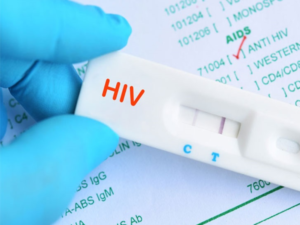 Xét nghiệm NAT HIV