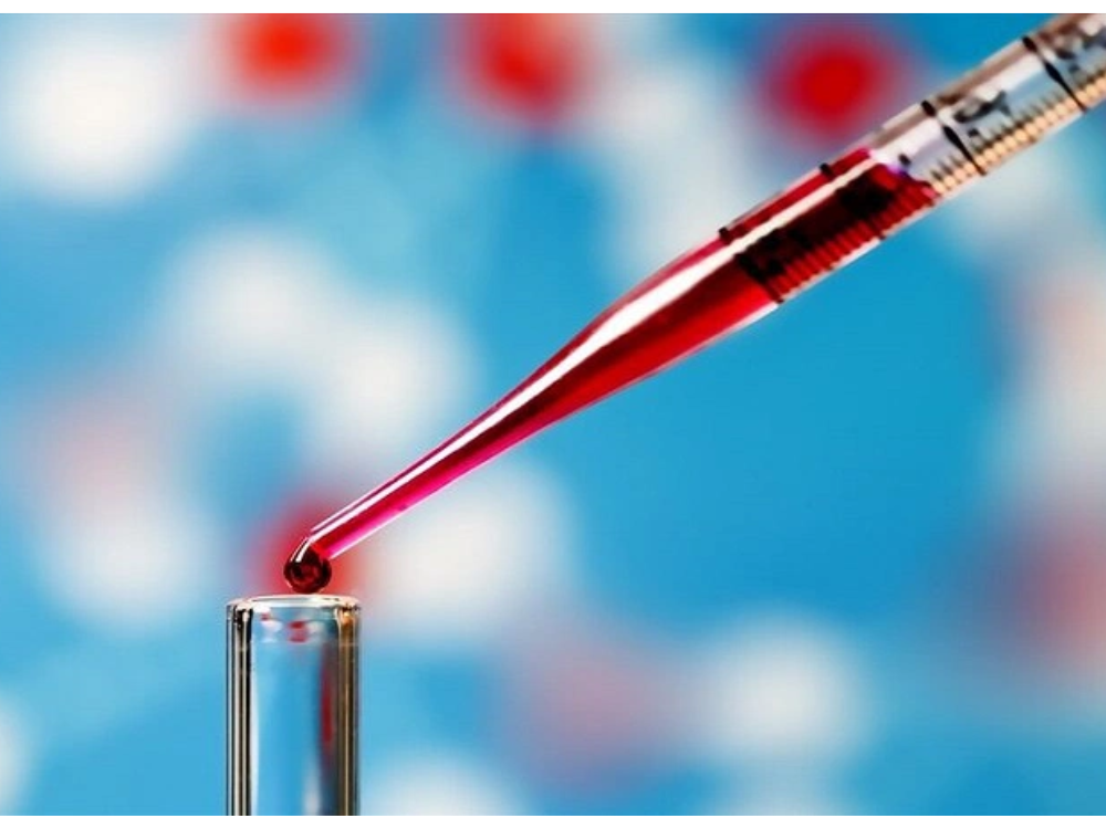 Ứng dụng của xét nghiệm NAT trong chẩn đoán HIV