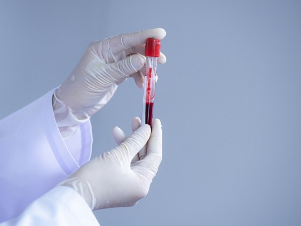 Xét nghiệm NAT HIV được thực hiện như thế nào?
