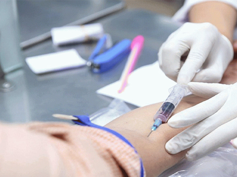 Cách lấy mẫu xét nghiệm bệnh xã hội 
