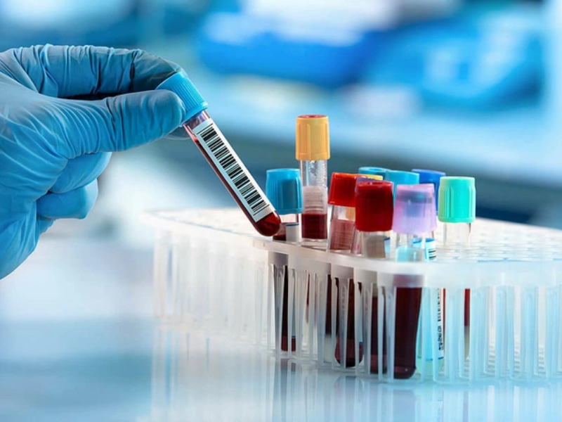 Các phương pháp xét nghiệm Elisa HIV 