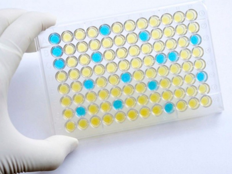 Xét nghiệm Elisa HIV có chính xác không? 