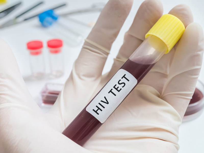 Xét nghiệm HIV Combi PT có chính xác không?