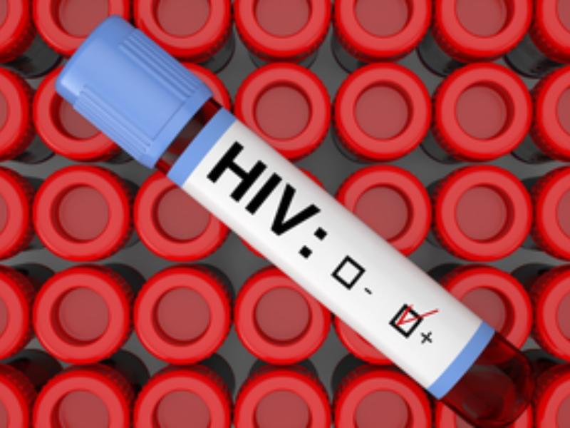 Người bệnh cần làm gì khi nhận kết quả dương tính HIV?