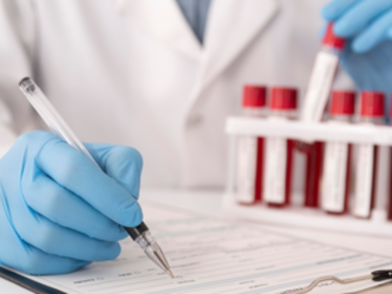 Lựa chọn dịch vụ xét nghiệm HIV an toàn và uy tín tại TestSGN